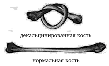 Декальцинированная кость и нормальная кость.