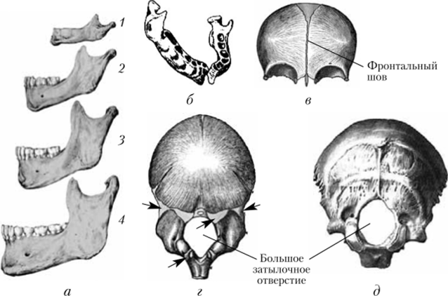 Кости черепа человека.