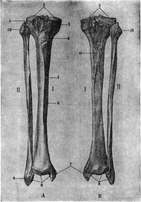 Кости голени (правой). А—спереди; Б — сзади; / — большеберцовая кость; II — малоберцовая кость.