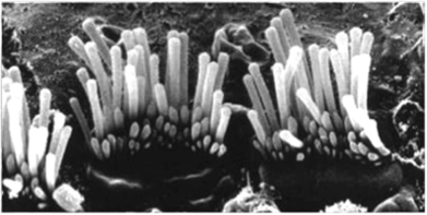 Волосковые клетки с тонкими стереоресничками (фотография, сделанная при помощи электронного микроскопа), по J. Magnus и А. В. Peltor.