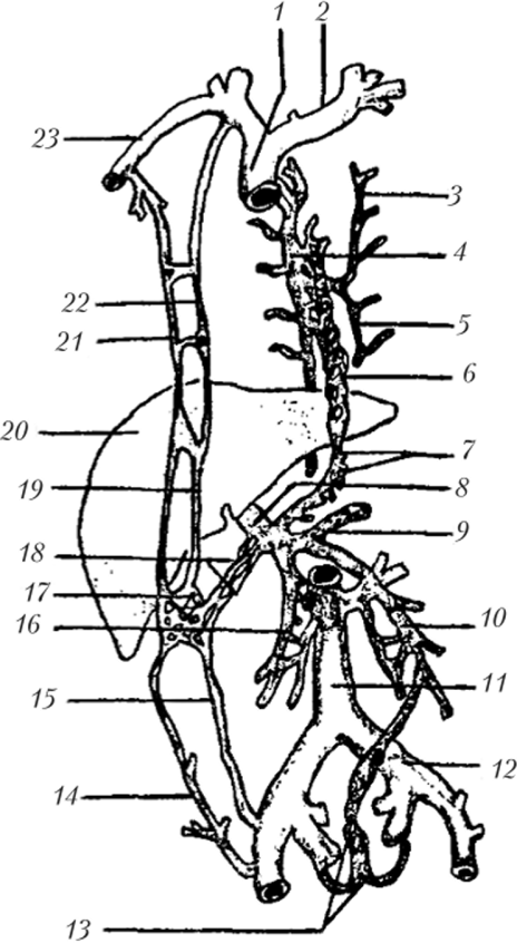 Схема анастомозов между воротной, верхней и нижней полыми венами.