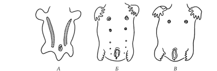 А — зародыш в возрасте 5 недель (млечные линии); Б —дифференцировка пяти пар сосков; В — зародыш в возрасте 7 недель Рис. 15.4. Эмбриогенез передней брюшной стенки человека.