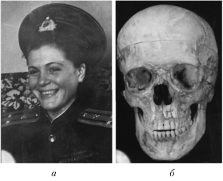 Прижизненная фотография пропавшей женщины (а) и женский череп неизвестного трупа (б).