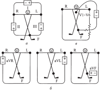 Стандартные (а, б) и грудные (в) схемы подключения электродов (отведений) электрокардиографа.