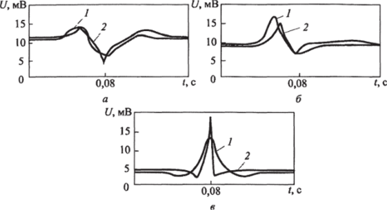 Модельные / и экспериментальные 2 кривые ЭКГ при сигналах в отведенияхVI (a), V3 (б) и V5 (в).