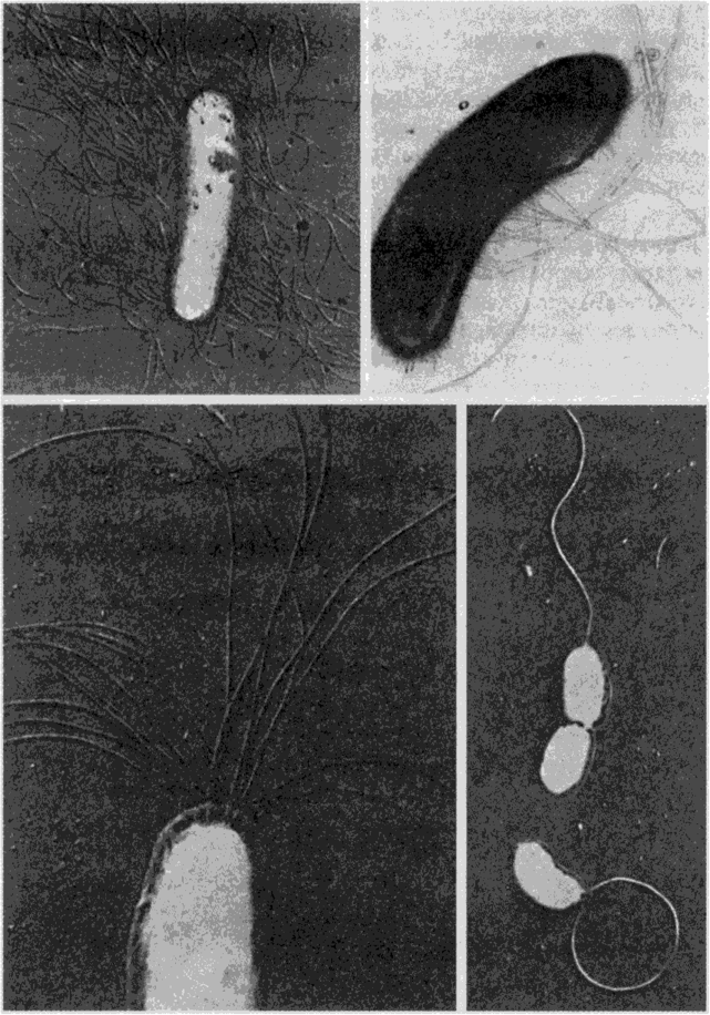 Бактерии с разными типами жгутикования. Электронная микрофотография.