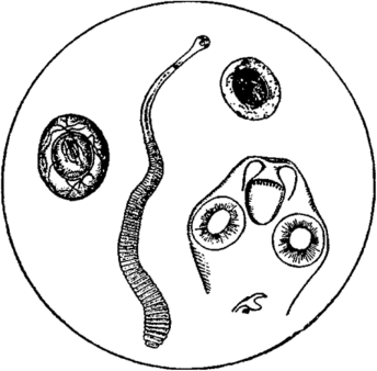 Карликовый цепень, яйцо его, головка; от полюсов оболочки отходят характерные извивающиеся филаменты; под сколексом показан.
