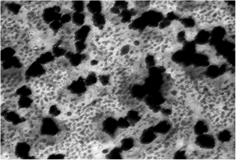 Изображение, полученное с помощью просвечивающего электронного микроскопа (колоидные частицы Au-Ag).