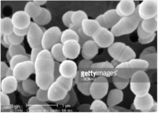 Streptococcus lactis (электронная микрофотография).