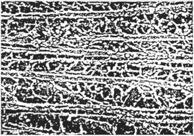 Микроэлектронная фотография микротрубочек со срезов головного мозга.