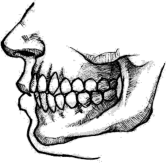 Ножницеобразный тип прикуса и соответствующая им форма смыкания губ.