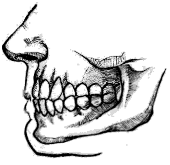 Щипцеобразный (прямой) тип прикуса и соответствующая им форма смыкания губ.