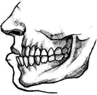 Ступенчатый тип прикуса и соответствующая им форма смыкания губ.