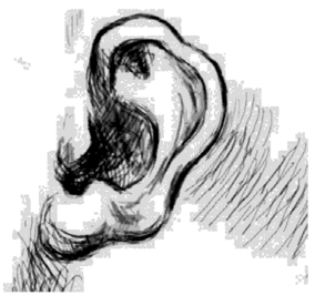 Особенности ушной раковины — ломанный контур завитка.