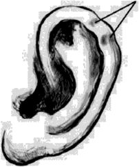 Особенности ушной раковины — вертикальная складка на завитке.