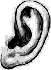 Особенности ушной раковины — вогнутая мочка.