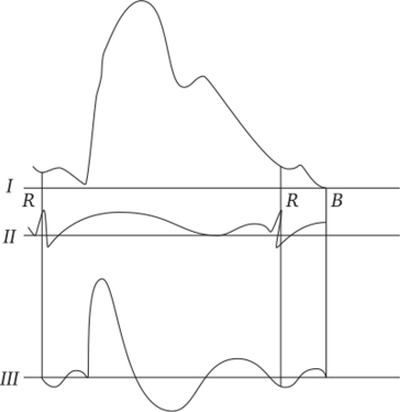 Сравнение сигналов фотоплетизмограммы, ЭКГ и сигнала пульсовой волны.