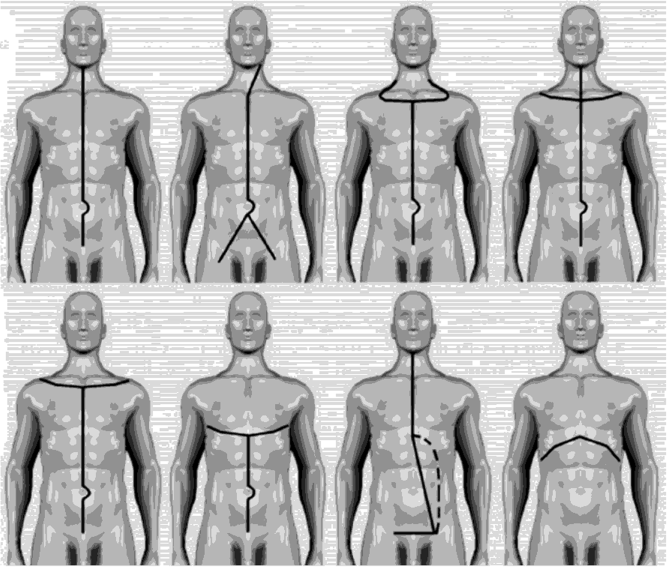 Разрезы мягких тканей передней поверхности тела для доступа к органам шеи, грудной, брюшной полостей, полости таза.