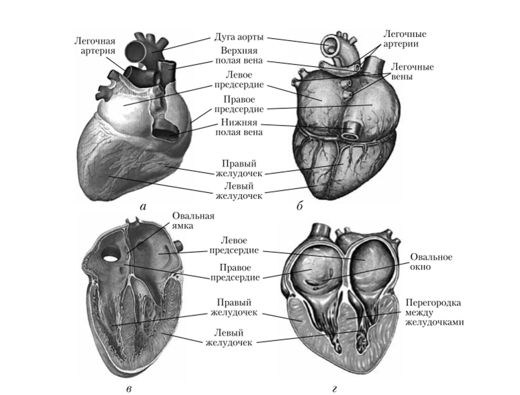 Сердце взрослого человека («, в) и новорожденного (б, г).