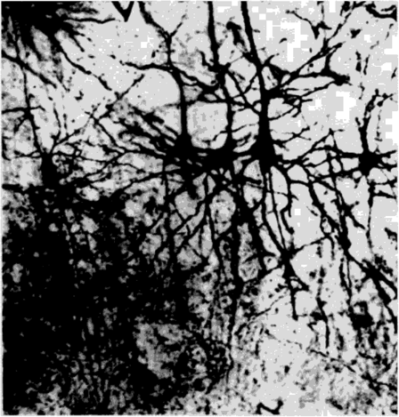 Колонка апикальных дендритов, небольшого ансамбля пирамидных нейронов.