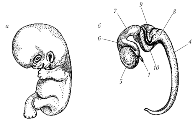 Эмбрион человека (а) и его головной мозг (б) на стадии пяти мозговых пузырей.