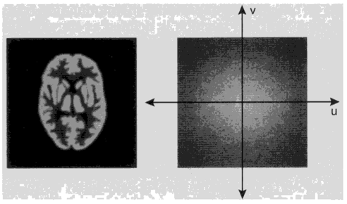 Поперечное изображение мозга и его соответствующее двумерное преобразование Фурье [4].