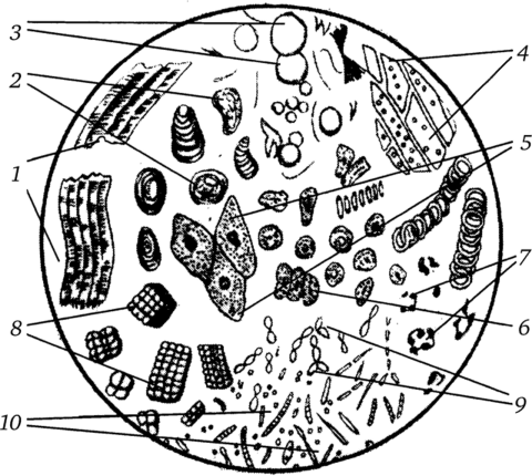 Общий вид содержимого желудка под микроскопом.