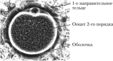 Неоплодотворенная яйцеклетка (электронная микроскопия).