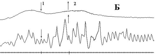 Рис. 4. Синхронная реакция двух токовых датчиков на воздействие характеристического поля неактивированной и активированной воды: А: 1 - приход экспериментатора в ЭП; 2 - неактивированная вода залита в сосуд; 3 - вода из сосуда удалена; Б: 1 -активированная вода залита в сосуд; 2 - вода удалена.
