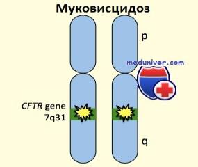 Мутация гена МВТР в середине длинного плеча 7 аутосомы [2].