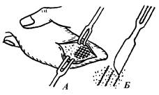 Нанесение бороздок (насечек) на наружную поверхность хряща для его местного ослабления (А). Положение лезвия скальпеля при нанесении бороздок (Б).