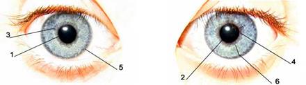 Применение иридодиагностики при болезнях глазной оболочки.