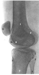 Коленный сустав, правый. Вид сбоку (рентгеновский снимок).