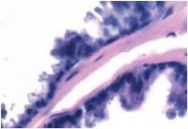 Железистый эпителий дорсолатеральных отделов предстательной железы крысы с сульпиридной моделью ДГПЖ (световая микроскопия, увеличение х1000, окраска гематоксилином и эозином).