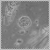 Электронные фотографии клетки и цисты E.histolytica.
