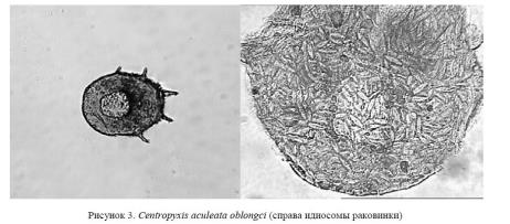 Об особенностях идентификации почвенной микрофауны при помощи проекционного микроскопа.