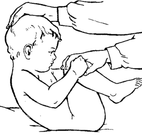 Особенности использования точечного массажа у больных раннего возраста.