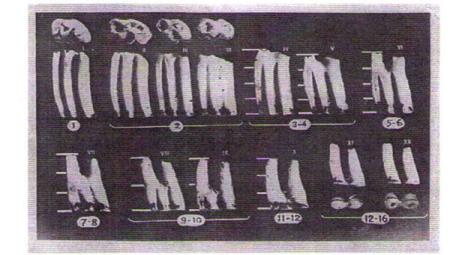 развития коря второго верхнего коренного зуба у рыжей и красной полевок (Тупикова и др. 1970) 1-16 месяцы жизни; I-XII - условные возрастные группы.