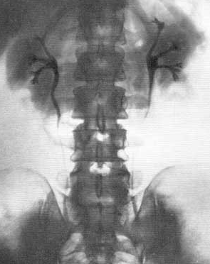 Введение. Рентгенодиагностика мочеполовых органов.