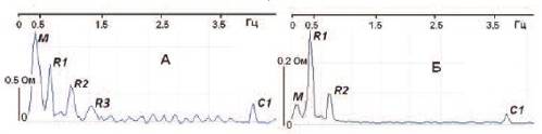 Примеры спектрограмм МП.