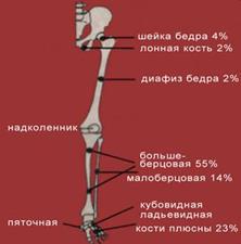 Риск перелома кости в зависимости от величины и повторяемости нагрузки.