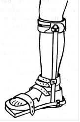 Ортопедическая обувь А. Скарпа.