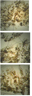 Рисунок 4 Субстратный мицелий микромицета Gibellina cerealis на КГА (ориг.).