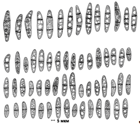 Рисунок 9 Аскоспоры микромицета Gibellina cerealis на КГА (ориг.).