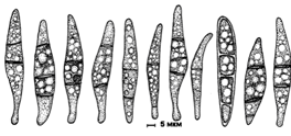 Рисунок 10 Споры микромицета Gibellina cerealis, сформировавшиеся из стерильных аск на КГА (ориг.).