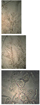 Онтогенез микромицета Gibellina cerealis Pass. in vitro.