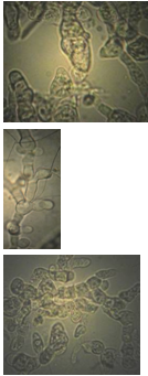 Рисунок 3 Поверхностный мицелий микромицета Gibellina cerealis на КГА (ориг.).