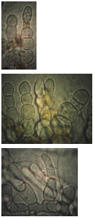 Субстратный мицелий микромицета Gibellina cerealis на КГА (ориг.).