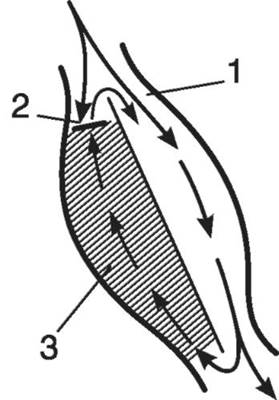 Схема механизма re-entry. Участок миокарда - задняя стенка левого желудочка.