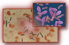 Clostridium perfringens под микроскопом.